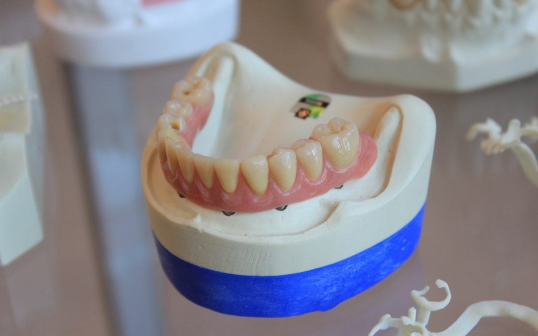 5 Ways to Damage Your Dentures 1