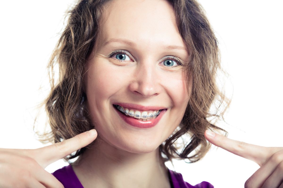 Braces treatment by Archstone Dental & Orthodontics